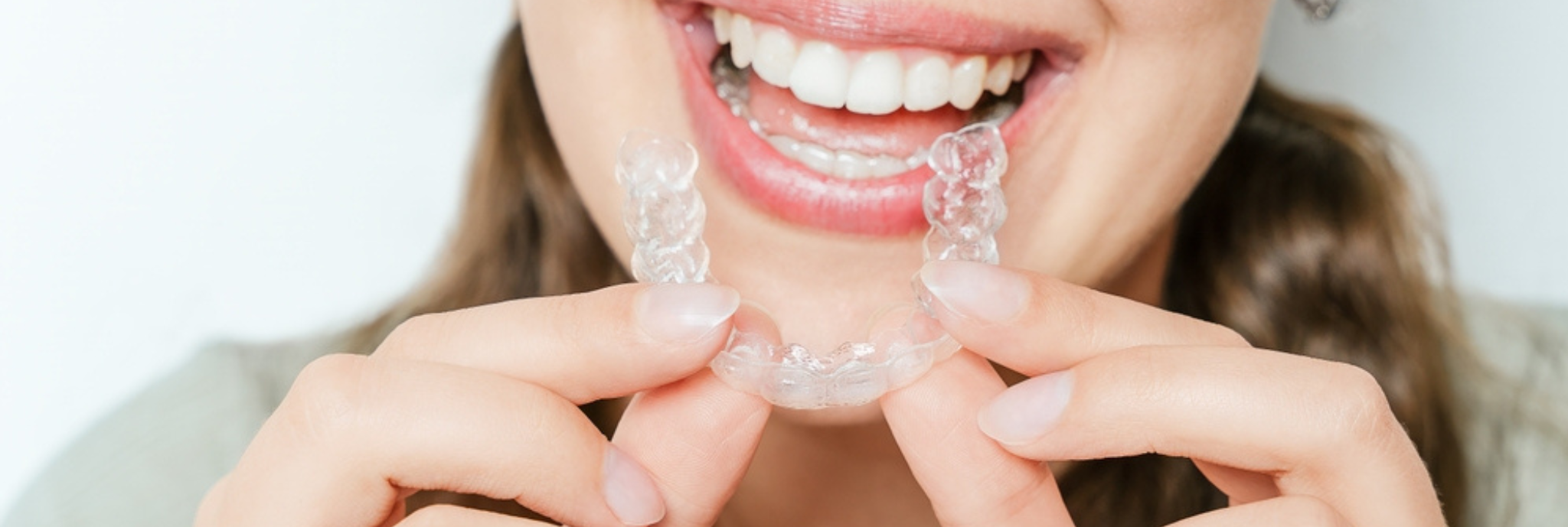 traitement invisalign orhodontie