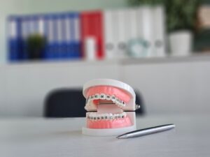 orthodontie faux dentier